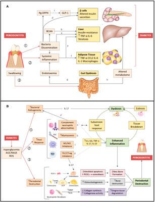 Current scientific evidence for why periodontitis should be included in diabetes management